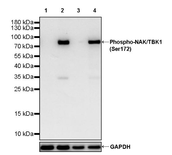 Phospho-NAK/TBK1 (Ser172) Recombinant Rabbit mAb (S-2481-14)