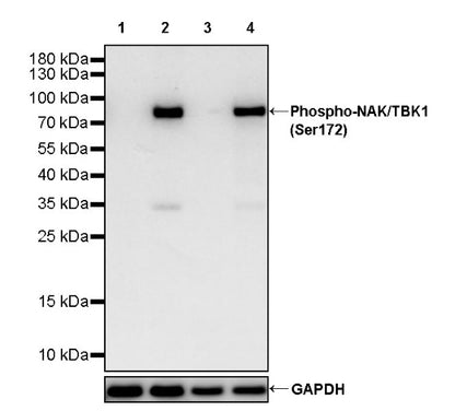 Phospho-NAK/TBK1 (Ser172) Recombinant Rabbit mAb (S-2481-14)