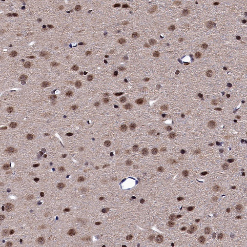 Keap1 Recombinant Rabbit mAb (S-1520-8)