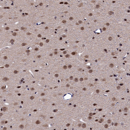 Keap1 Recombinant Rabbit mAb (S-1520-8)