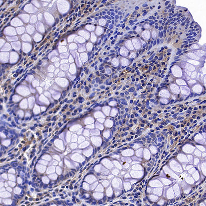 TXNRD1 Mouse mAb (S-M0053)