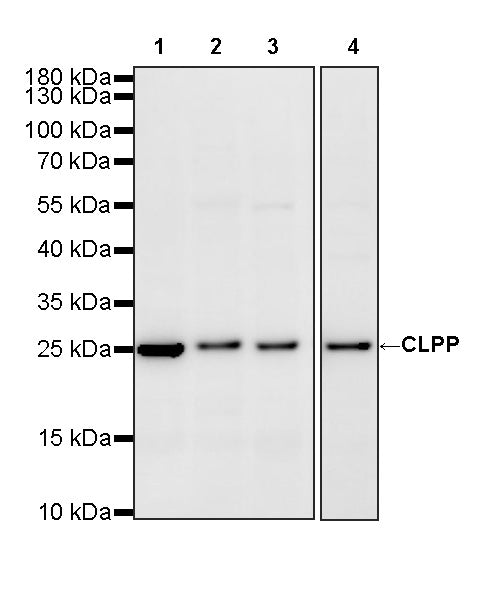 CLPP Recombinant Rabbit mAb (S-4169-31)