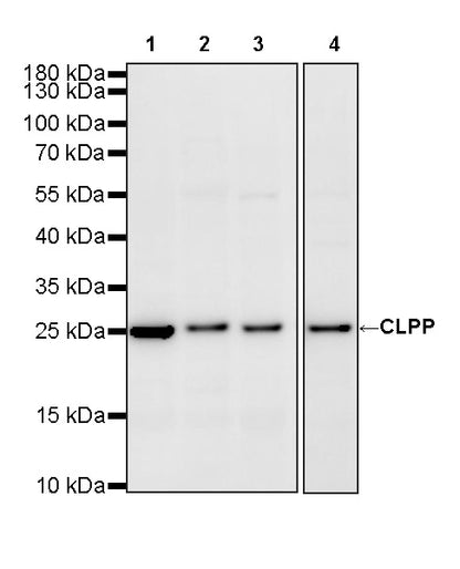 CLPP Recombinant Rabbit mAb (S-4169-31)