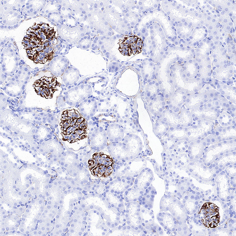 Nestin Recombinant Rabbit mAb (S-3890-61)