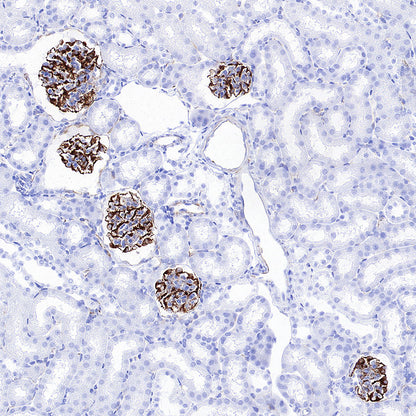 Nestin Recombinant Rabbit mAb (S-3890-61)