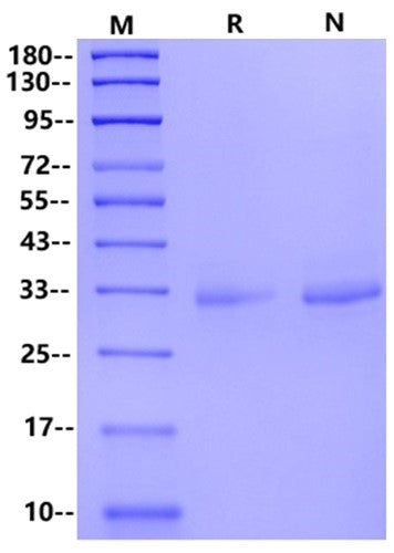 MSLN/Mesothelin (37-286) His Tag Protein, Human
