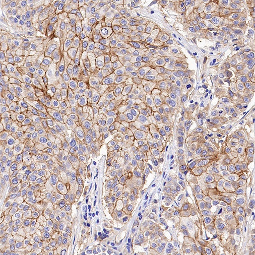 Scavenging Receptor SR-BI Recombinant Rabbit mAb (S-1736-15)