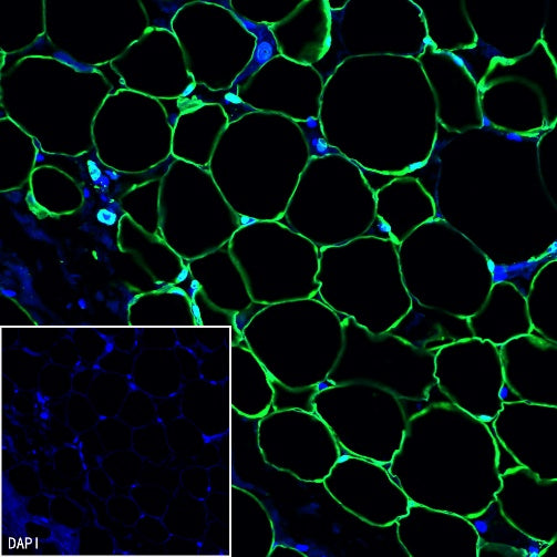 FABP4 Recombinant Rabbit mAb (S-1360-168)