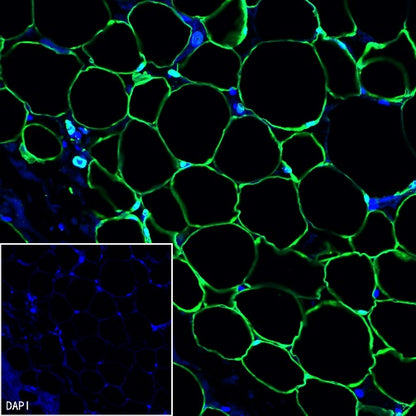 FABP4 Recombinant Rabbit mAb (S-1360-168)
