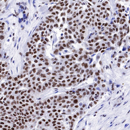TAF15 Recombinant Rabbit mAb (S-1508-53)