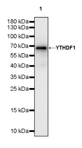 YTHDF1 Recombinant Rabbit mAb (S-2443-28)