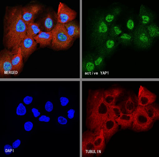 active YAP1 Recombinant Rabbit mAb (S-516-142)