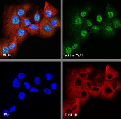 active YAP1 Recombinant Rabbit mAb (S-516-142)