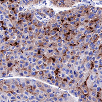 Glypican-3 Recombinant Rabbit mAb,PBS Only (SDT-R032)