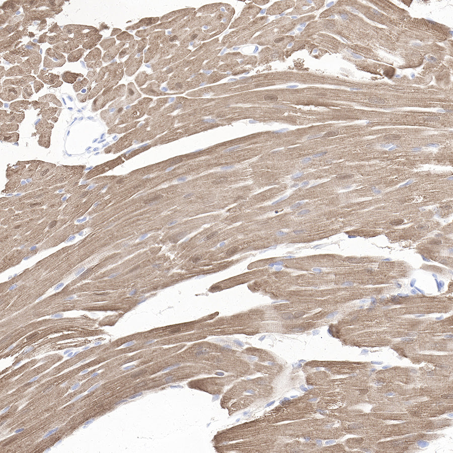 Myoglobin Recombinant Rabbit mAb (SDT-097-10)