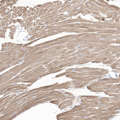 Myoglobin Recombinant Rabbit mAb (SDT-097-10)