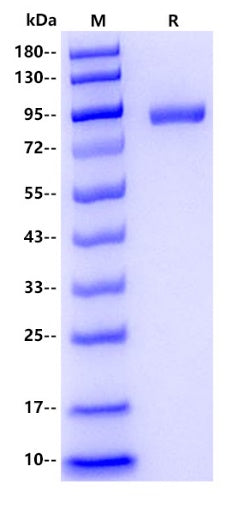 Human Angiotensin Converting Enzyme 1 Protein, His tag
