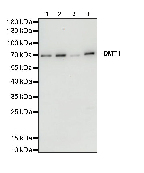 DMT1 Recombinant Rabbit mAb