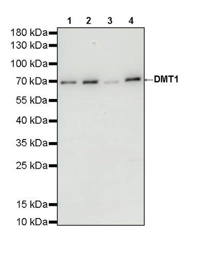 DMT1 Recombinant Rabbit mAb
