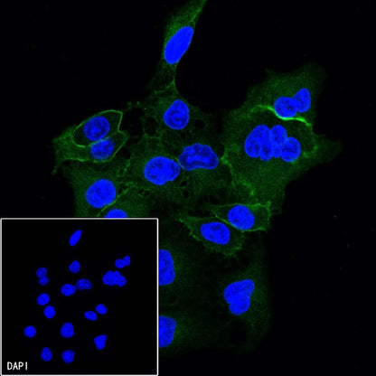 Integrin beta1/CD29 Mouse mAb (S-933-228)