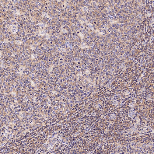 IRF-5 Recombinant Rabbit mAb (S-3056-28)