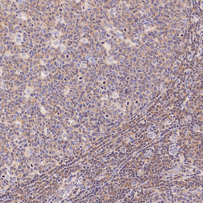 IRF-5 Recombinant Rabbit mAb (S-3056-28)