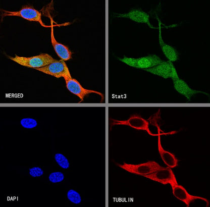 Stat3 Recombinant Rabbit mAb (S-1393-64)