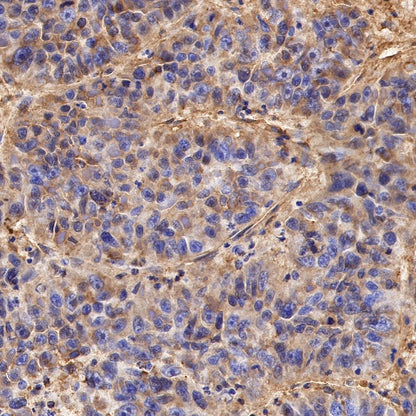 Citrate synthetase Recombinant Rabbit mAb (S-1708-56)