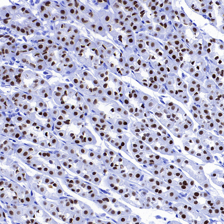 FOXA1 Recombinant Rabbit mAb (S-4339)