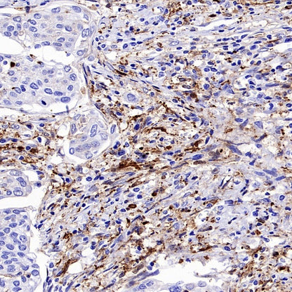 FAP Recombinant Rabbit mAb (S-3094-29)
