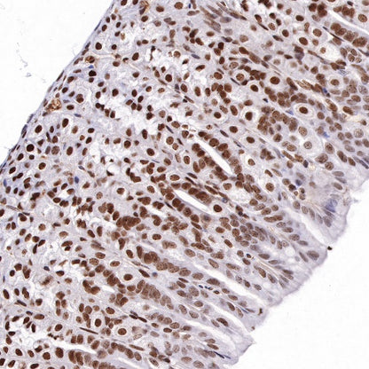 S-RMab® ATRX Recombinant Rabbit mAb (SDT-458-37)