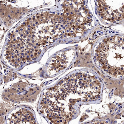 Galectin-1 Recombinant Rabbit mAb (S-1221-32）