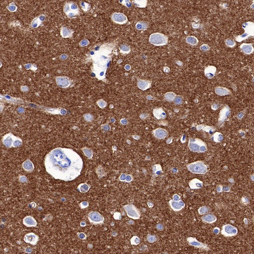 α-Synuclein Recombinant Rabbit mAb (S-441-86)