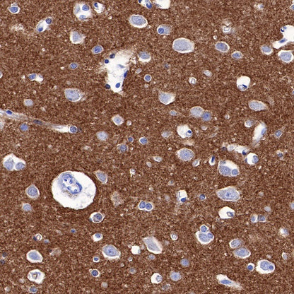 α-Synuclein Recombinant Rabbit mAb (S-441-86)