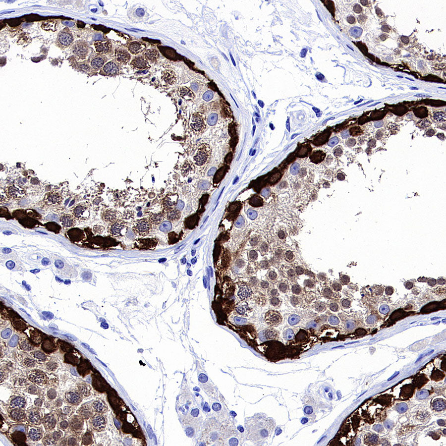 MAGE-A4 Recombinant Rabbit mAb (S-3868-66)