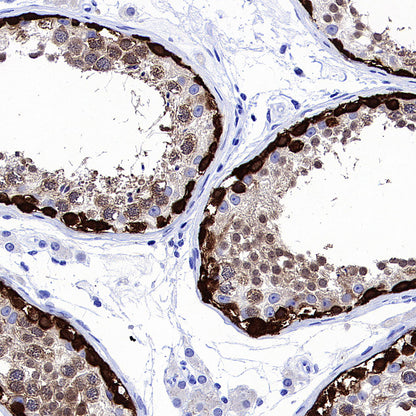 MAGE-A4 Recombinant Rabbit mAb (S-3868-66)