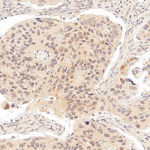 SMN2 Recombinant Rabbit mAb (S-4920-4)