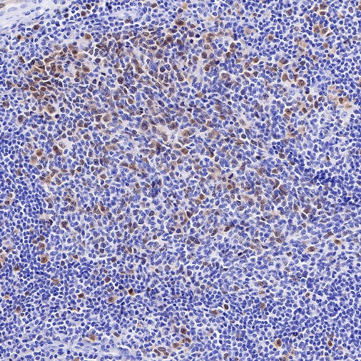 Rad51 Recombinant Rabbit mAb (S-R347)