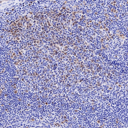 Rad51 Recombinant Rabbit mAb (S-R347)