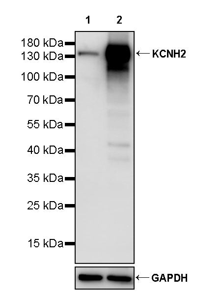 KCNH2 Recombinant Rabbit mAb (S-3727-63)