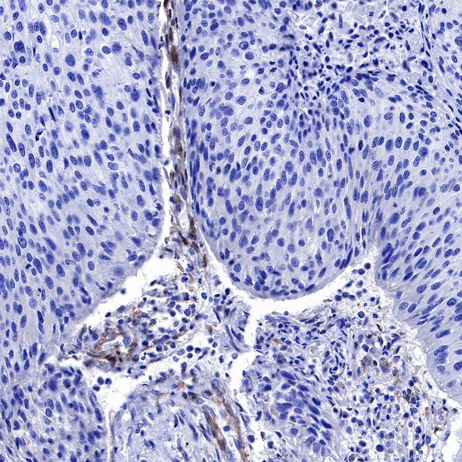 PTEN Recombinant Rabbit mAb (SDT-R074)