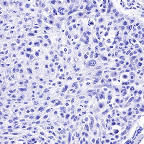 CK8/18 Recombinant Rabbit mAb (SDT-P005)