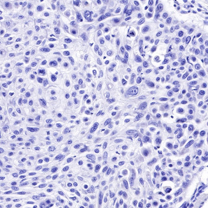 CK8/18 Recombinant Rabbit mAb (SDT-P005)