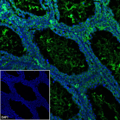 Mitofilin Recombinant Rabbit mAb (S-2277-37)