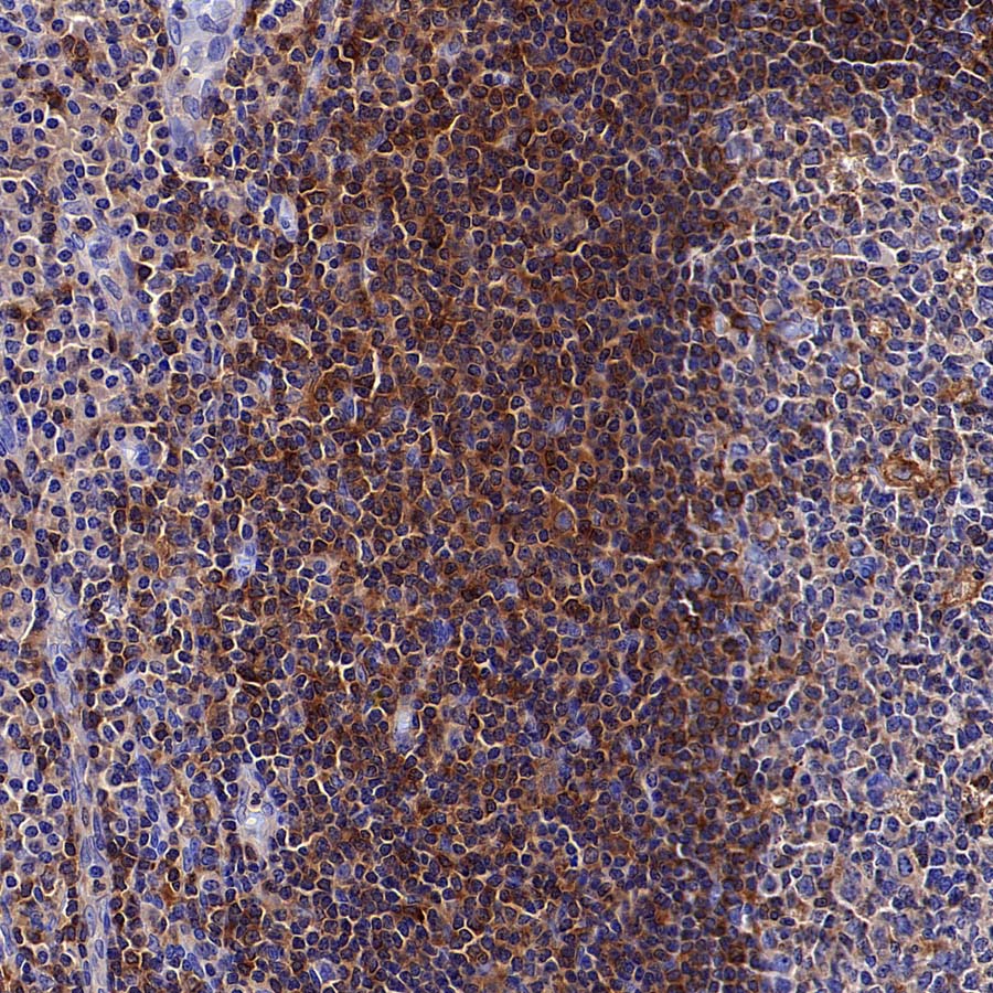 ARHGAP25 Recombinant Rabbit mAb (S-4005-5)