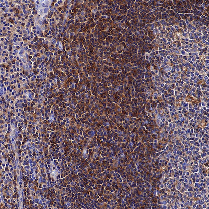 ARHGAP25 Recombinant Rabbit mAb (S-4005-5)