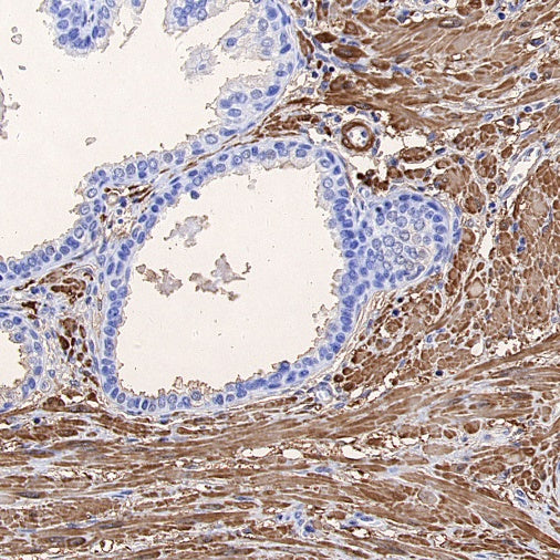 TAGLN/Transgelin Recombinant Rabbit mAb (S-1715-59)
