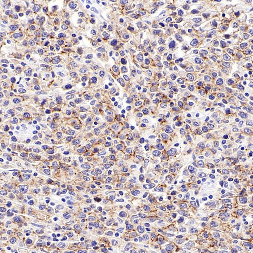 CD19 Mouse mAb (S-1039-46)