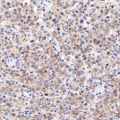 CD19 Mouse mAb (S-1039-46)