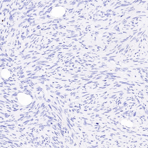 Claudin 1 Recombinant Rabbit mAb (SDT-1289-55)